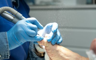 Soulager vos douleurs avec une pédicure pour ongle incarné à Luxembourg Ville !
